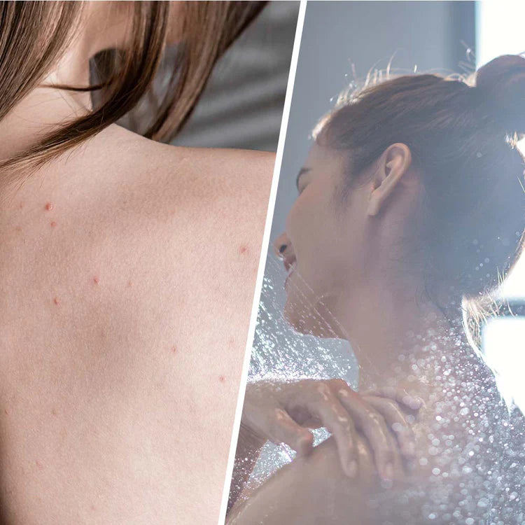 Gommage salicylique avec arbre à thé pour détoxification de la peau 250 ml