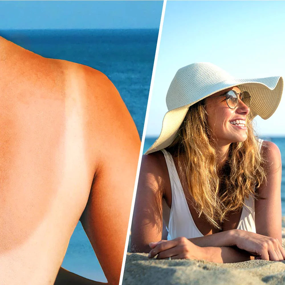 Pulvérisation de lotion apaisante avec de l'acide hyaluronique après le soleil - 200 ml