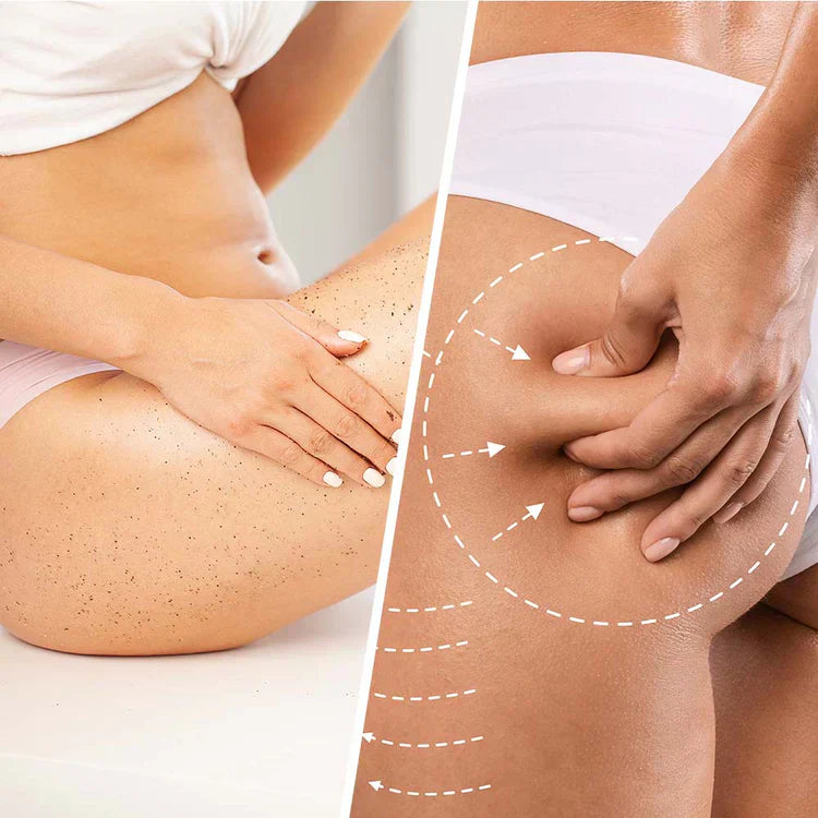 Gommage anti-cellulite de niacine avec noix de coco pour raffermir et lisser la peau 250 ml